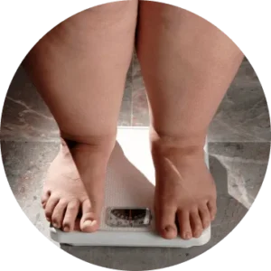 Overweight
